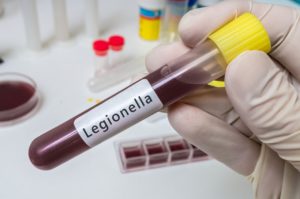 A gloved hand holds a test tube with Legionella written on the label. 