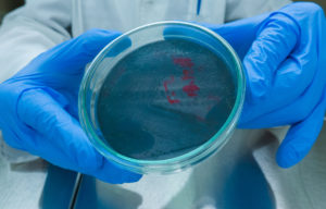 A lab worker wearing blue gloves holds a petree dish to test a sample for Legionella.