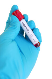 A gloved hand holds a vial with the word "legionella" written on the label.