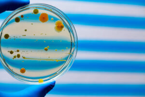 A gloved hand holds a petri dish with specimens against a blue and white background.