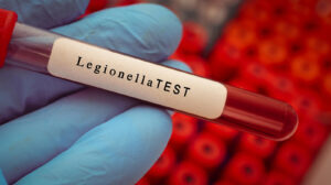 A gloved hand holds a Legionella testing vial.